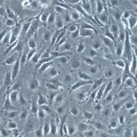 HUVEC细胞、HUVEC细胞、HUVEC细胞