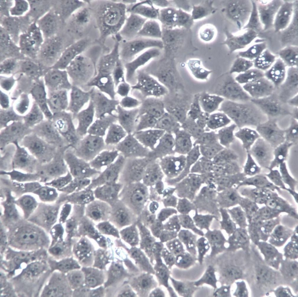 Ishikawa细胞、Ishikawa细胞、Ishikawa细胞