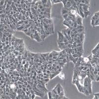 MDA-MB-361、MDA-MB-361细胞、MDA-MB-361