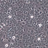 NCI-H292细胞、NCI-H292细胞、NCI-H292细胞