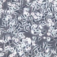 MIA PaCa-2细胞、MIA-PaCa-2、MIA PaCa-2