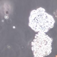 NCI-H716细胞、NCI-H716细胞、NCI-H716细胞