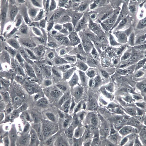 OS-RC-2细胞、OS-RC-2细胞、OS-RC-2肾癌细胞