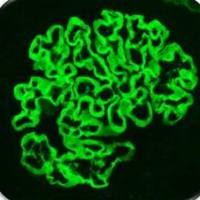 PTX-001AGBM绵羊抗大鼠肾小球基底膜血清 Sheep Anti-Rat Anti