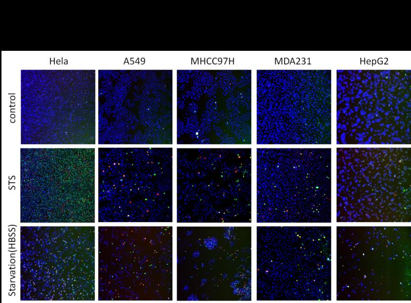 Caspase-3/7细胞凋亡快速检测试剂盒