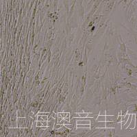 HMSC-bm人骨髓来源干细胞/人骨髓充质干细胞/人骨髓干细胞/流式鉴定