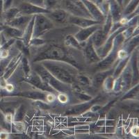 MDA-MB-231[ MDAMB-231; MDAMB231; MDA-231; MDA231; MB231]人乳腺癌细胞