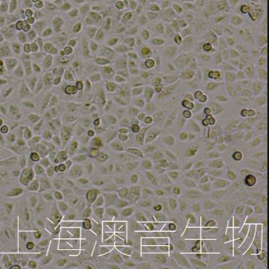 A549-GFP【A549/GFP】绿色荧光蛋白标记的人非小细胞肺癌细胞