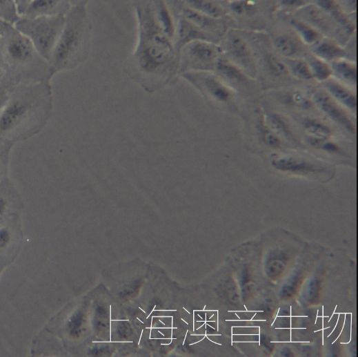 ARPE-19[ARPE19; Adult Retinal Pigment Epithelial cell line-19; NTC-200; NTC200]人视网膜色素上皮细胞