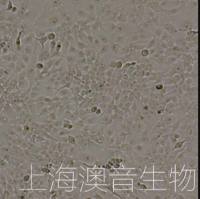 KYSE-150[KYSE 150; KYSE150; Kyse150; KY150]人食管鳞癌细胞