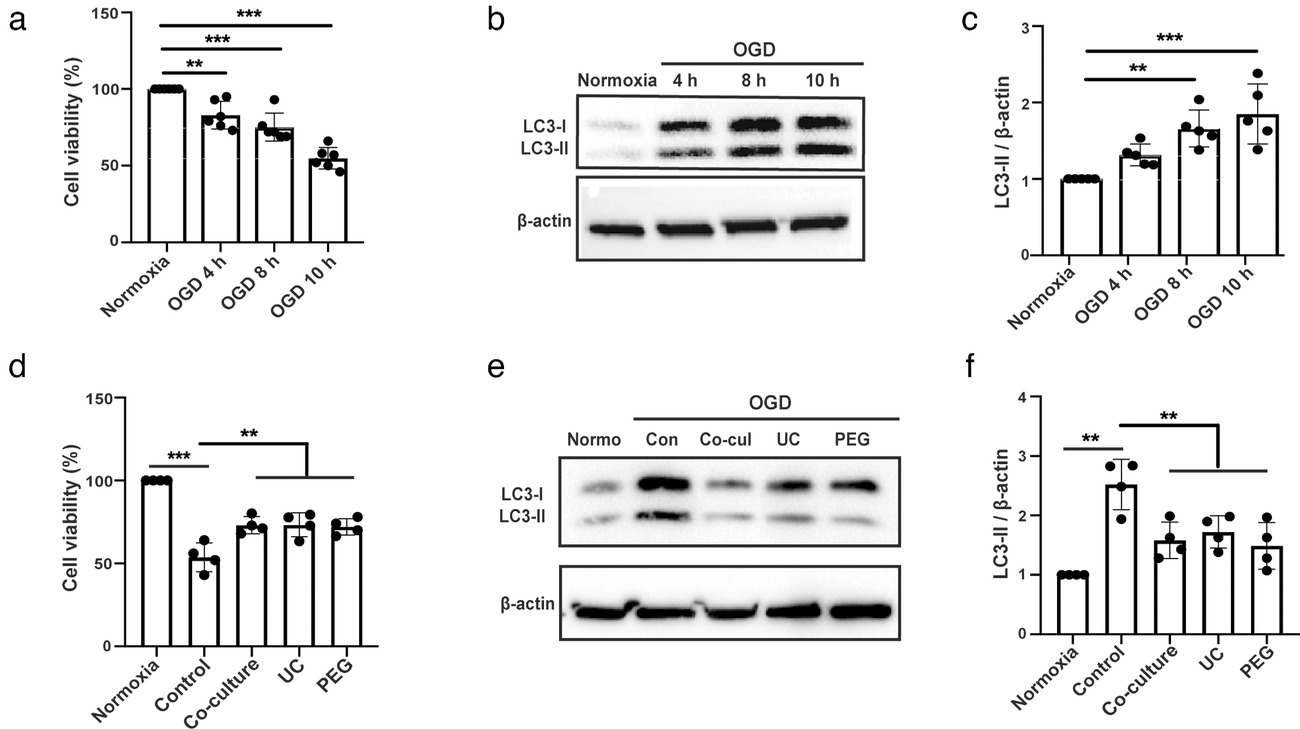 脂肪间充质干细胞通过细胞外囊泡转移miR25减少中风小鼠的自噬