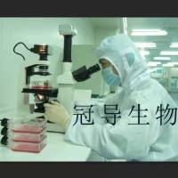 bEnd.3[BEND3] Cells;小鼠脑内皮瘤体外鲜活细胞|STR鉴定图谱