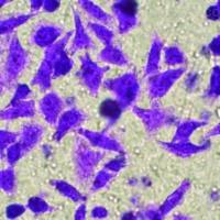 上海细胞侵袭实验