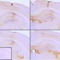 Tau(K18), P301L 突变蛋白 PFFs