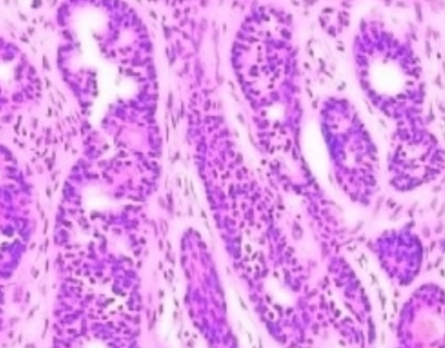 小鼠脑组织免疫组化实验