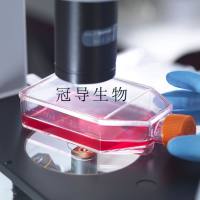 hTERT-RPE-1 Cells;人视网膜色素上皮体外鲜活细胞|STR鉴定图谱