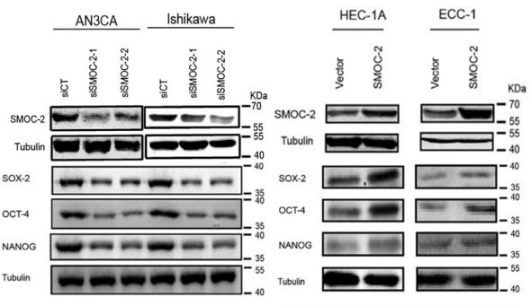 肿瘤干细胞研究套路:Wnt信号通路的激活