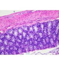 DSS溃疡性结肠炎模型构建