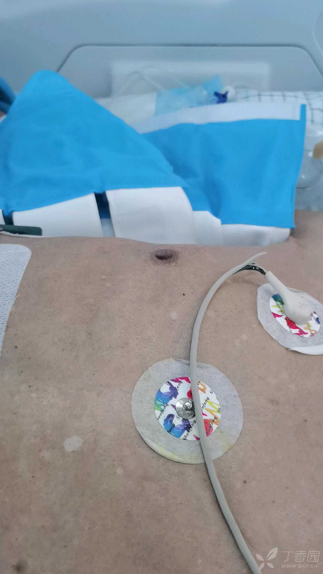 一眼洞穿之-------反常呼吸