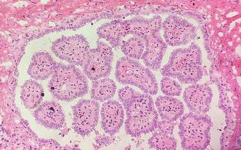 冰冻切片制作经验