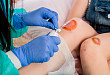 切口感染后外科医生一定要掌握的 8 种处理方法