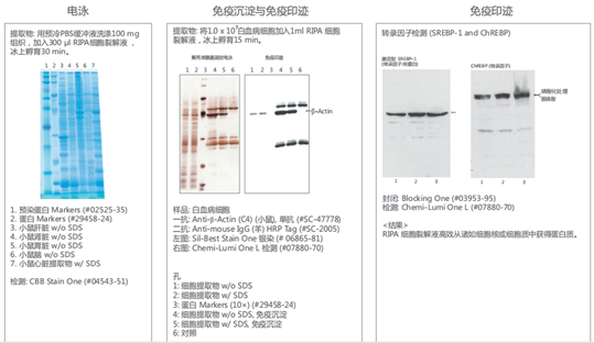 细胞裂解液 : RIPA Buffer