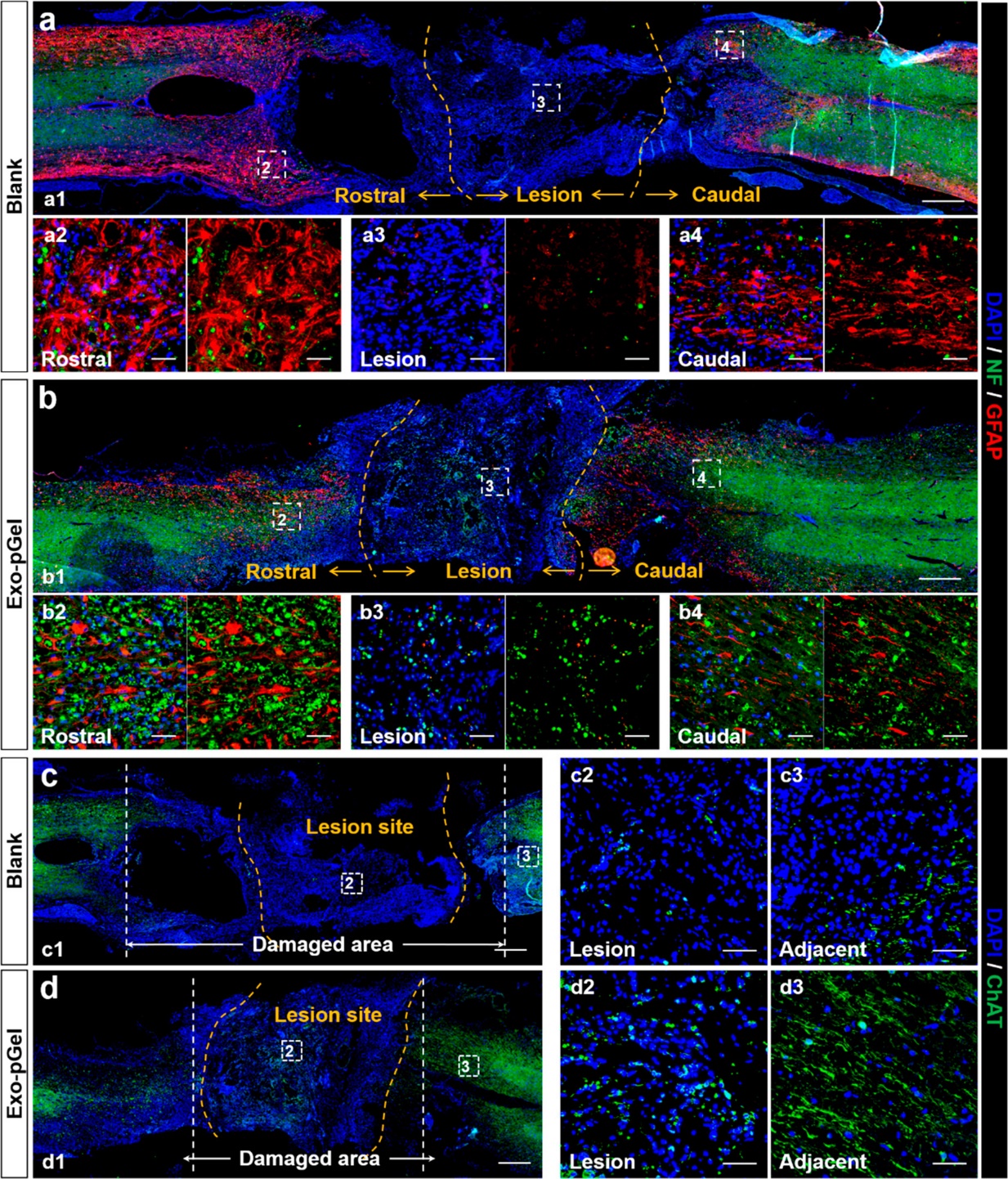 MSC来源的外泌体整合至水凝胶后移植治疗脊髓损伤