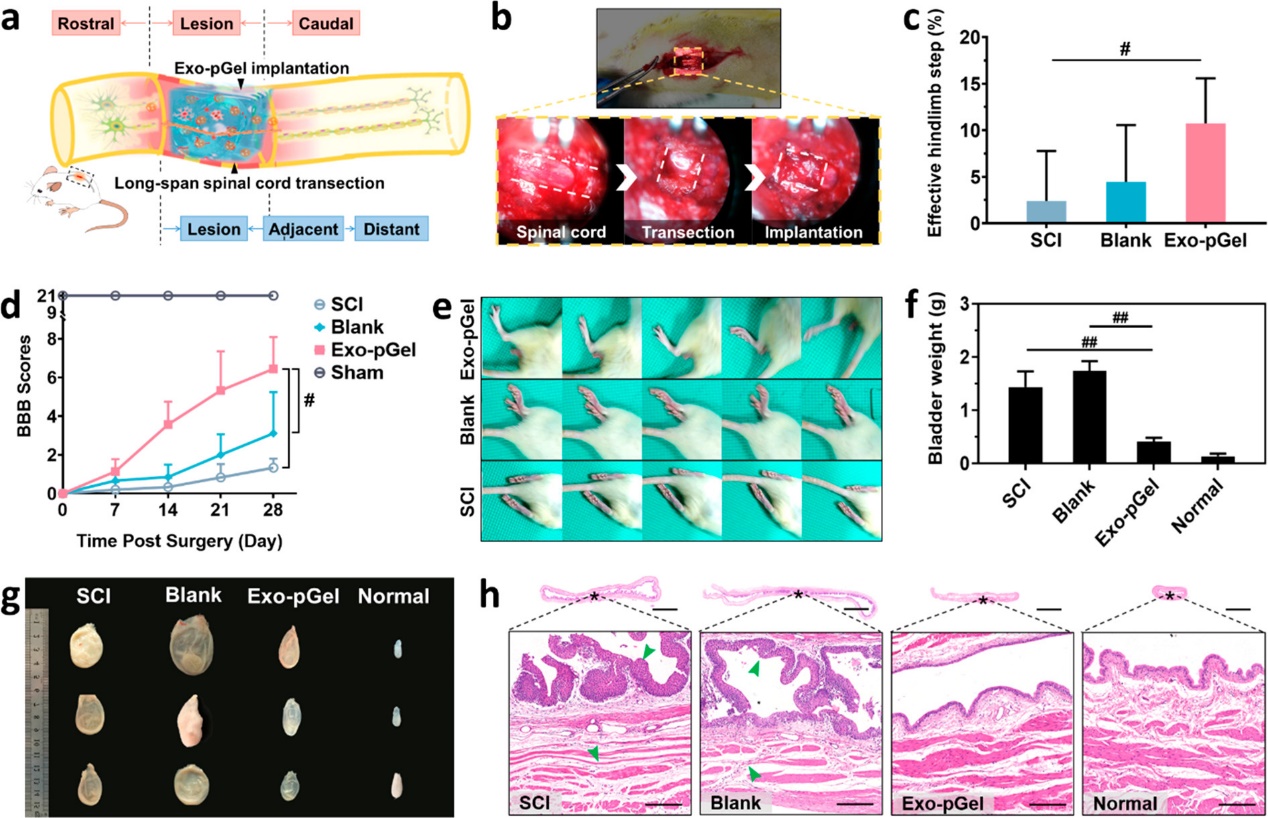 MSC来源的外泌体整合至水凝胶后移植治疗脊髓损伤