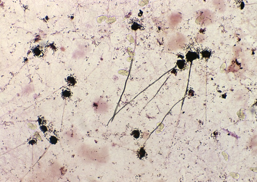 小鼠杂交瘤细胞株；W5 细胞培养的优点