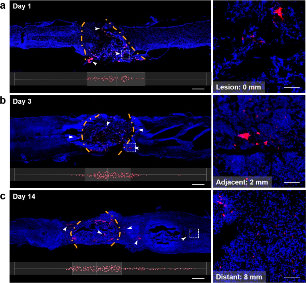 MSC来源的外泌体整合至水凝胶后移植治疗脊髓损伤