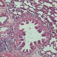 上海肺组织HE染色实验