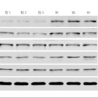 WB组学免疫检测
