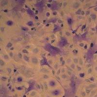 病理学甲苯胺蓝染色