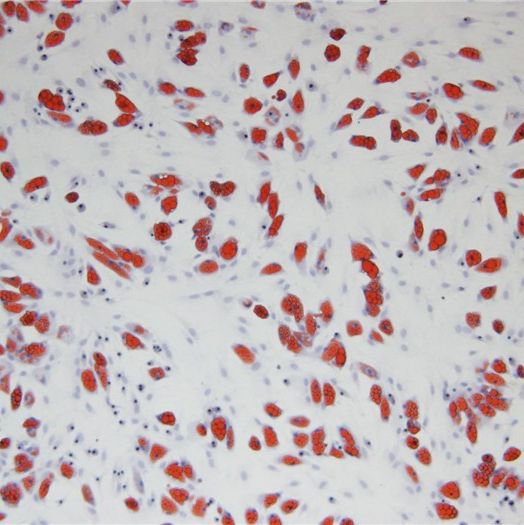 病理学油红O脂肪染色实验