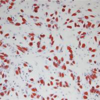 病理学油红O脂肪染色实验