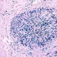 病理学普鲁士蓝染色