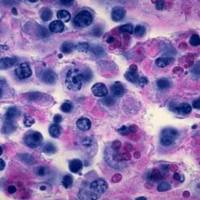 病理学粘液染色实验