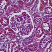 病理学Mallory染色