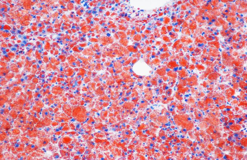 油红O染色的步骤及注意事项