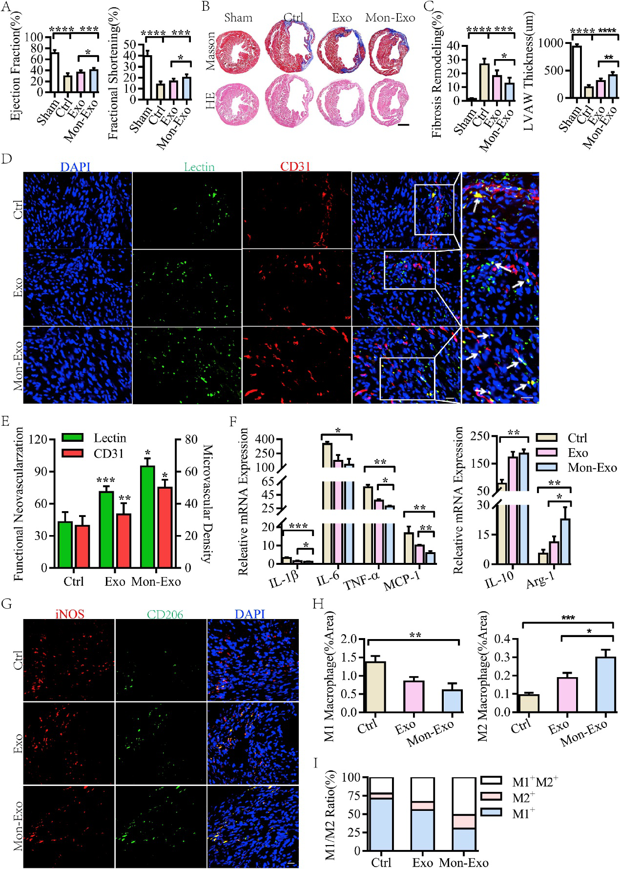 单核细胞膜融合间充质干细胞来源细胞外囊泡可增加其在心肌破裂模型中归巢