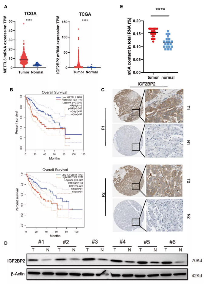 MeRIP-Seq助力揭示IGF2BP2促进肝癌生长的m6A-FEN1依赖性机制