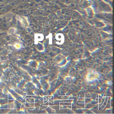 P19【P-19】小鼠畸胎瘤细胞