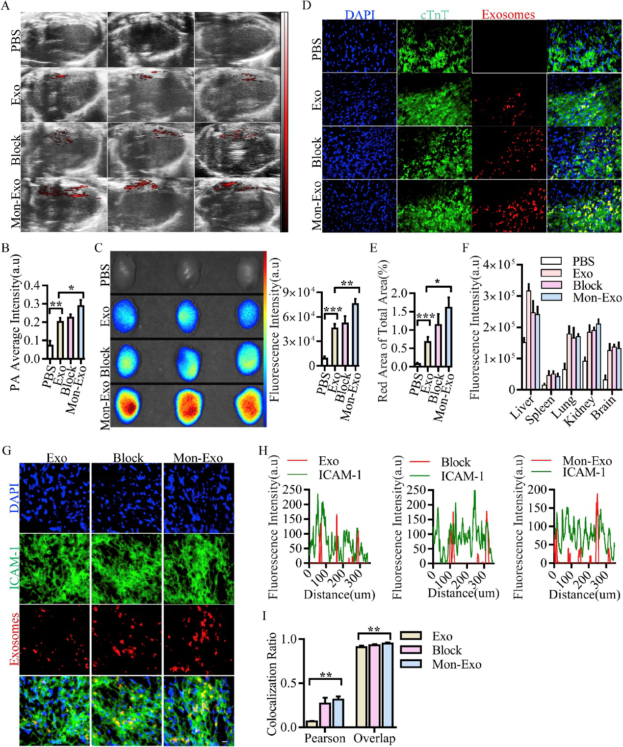 单核细胞膜融合间充质干细胞来源细胞外囊泡可增加其在心肌破裂模型中归巢