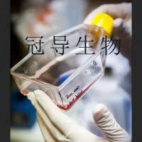 Biopsy xenograft of Pancreatic Carcinoma line-３ Cells;人原位胰腺腺癌体外鲜活细胞|STR鉴定图谱