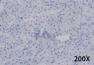 饮食诱导的非酒精性脂肪肝小鼠模型