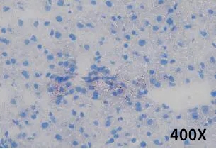 饮食诱导的非酒精性脂肪肝小鼠模型