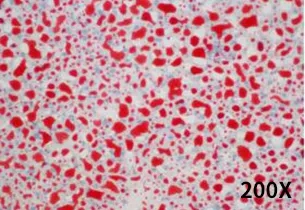 饮食诱导的非酒精性脂肪肝小鼠模型