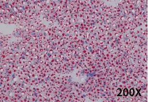 饮食诱导的非酒精性脂肪肝小鼠模型