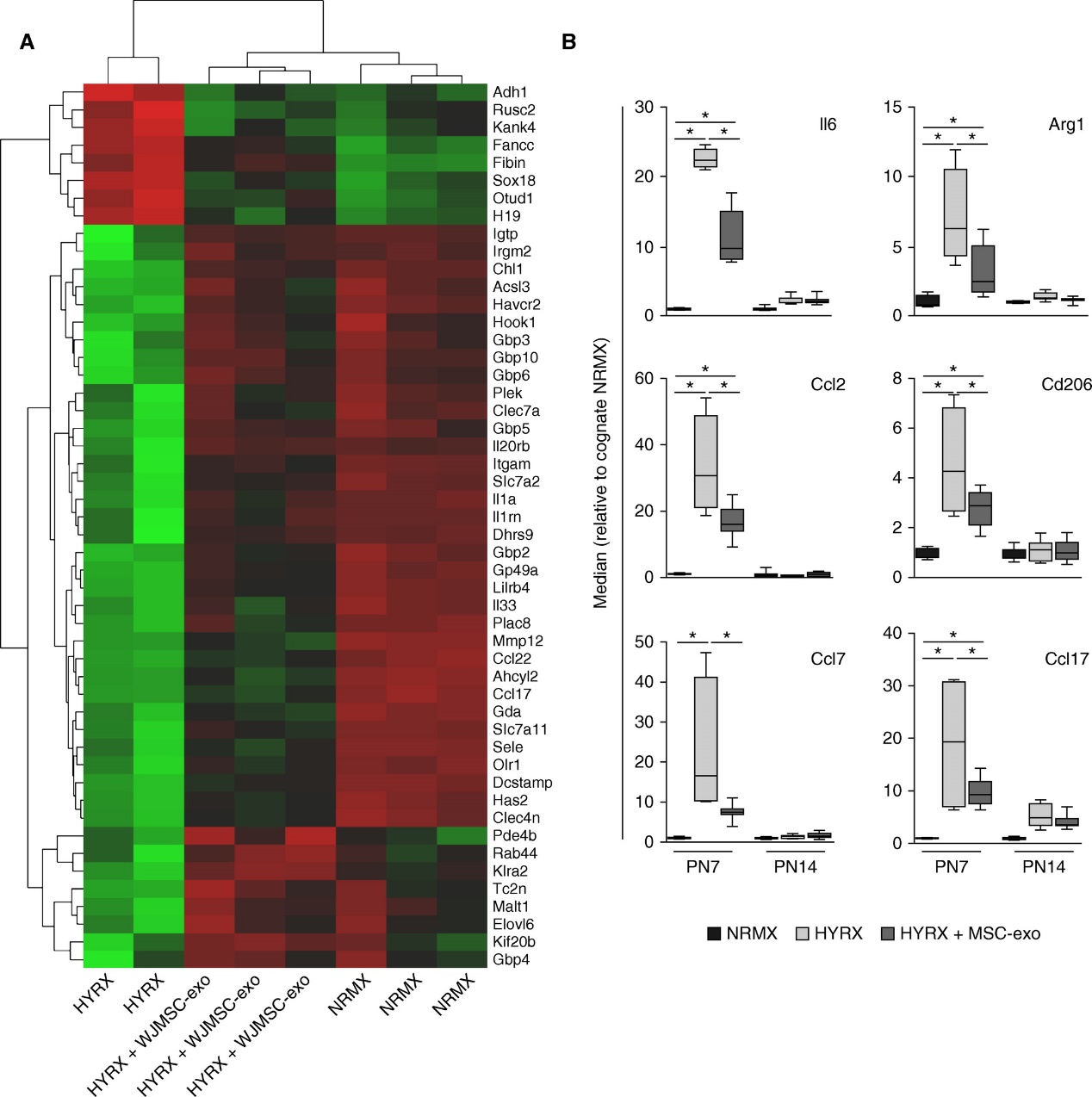 MSC来源的外泌体调节巨噬细胞免疫功能改善肺支气管发育不良恢复肺功能