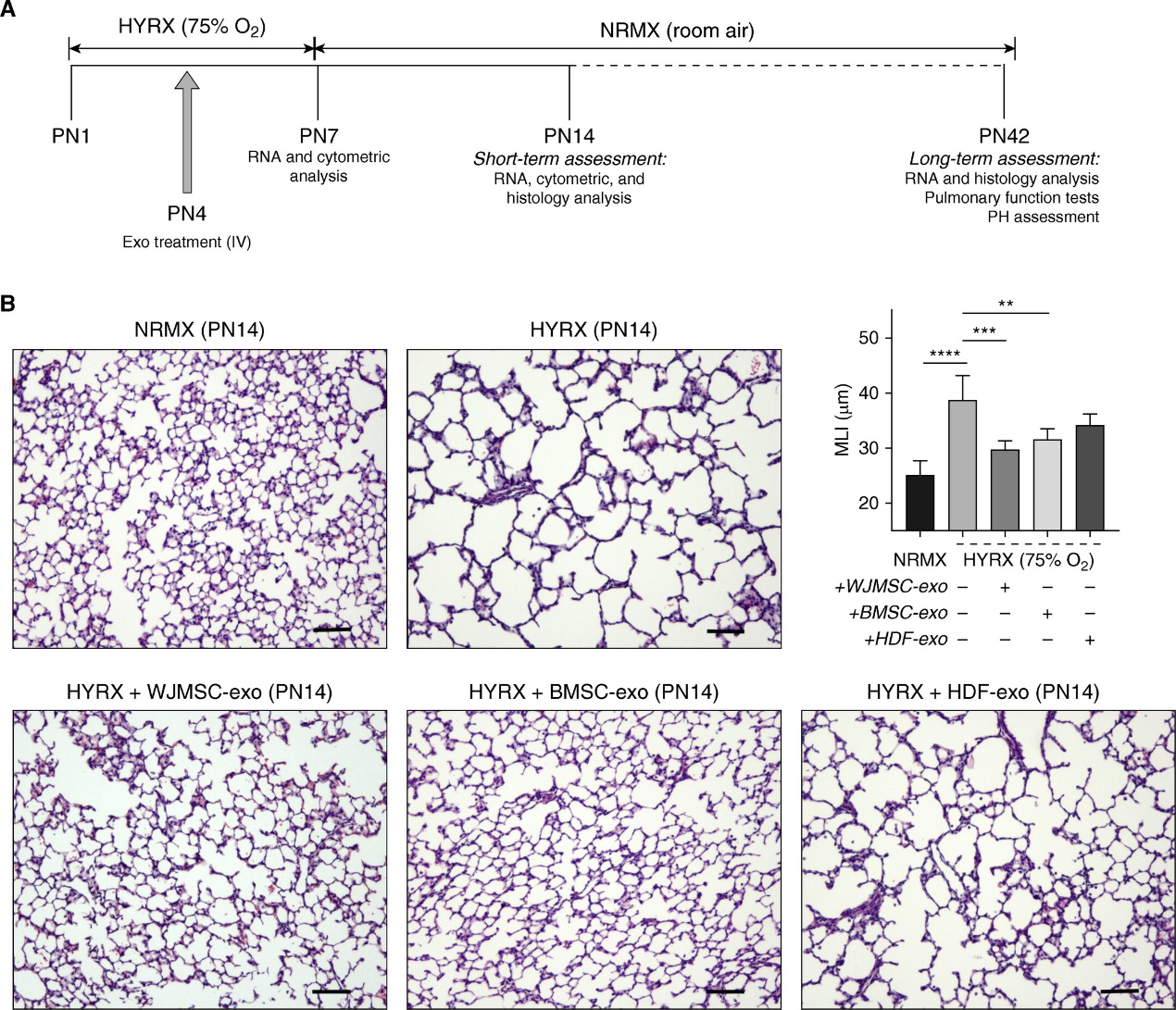 MSC来源的外泌体调节巨噬细胞免疫功能改善肺支气管发育不良恢复肺功能